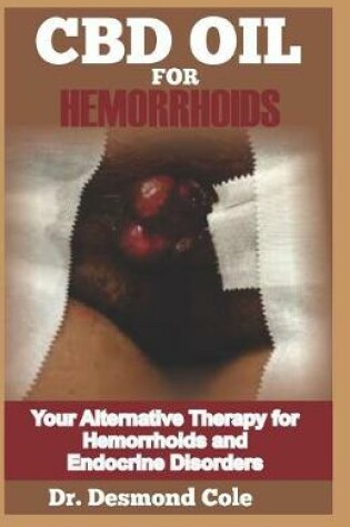 Cover of CBD Oil for Hemorrhoids