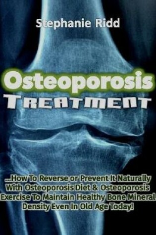 Cover of Osteoporosis Treatment: How to Reverse or Prevent It Naturally With Osteoporosis Diet and Osteoporosis Exercise to Maintain Healthy Bone Mineral Density Even In Old Age Today!