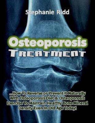 Book cover for Osteoporosis Treatment: How to Reverse or Prevent It Naturally With Osteoporosis Diet and Osteoporosis Exercise to Maintain Healthy Bone Mineral Density Even In Old Age Today!