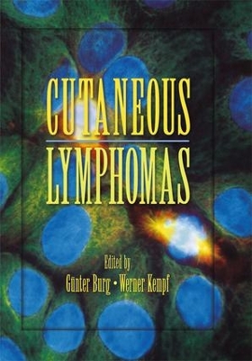 Cover of Cutaneous Lymphomas