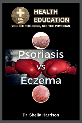 Book cover for Psoriasis vs. Eczema