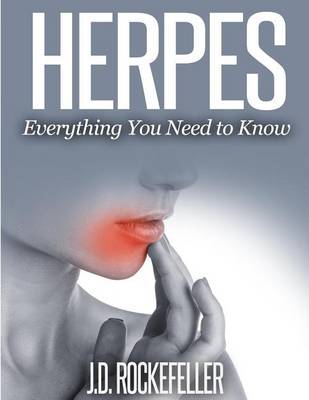 Book cover for Herpes