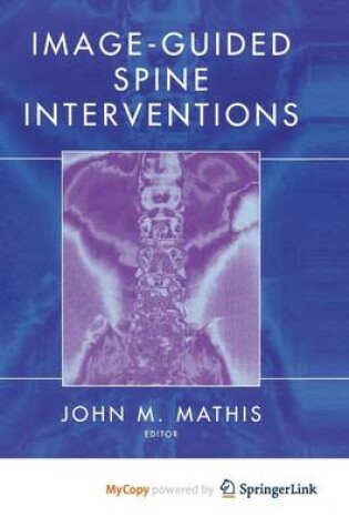 Cover of Image-Guided Spine Interventions