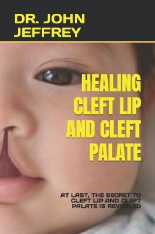 Cover of Healing Cleft Lip and Cleft Palate