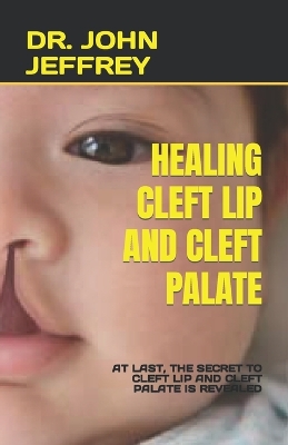 Book cover for Healing Cleft Lip and Cleft Palate