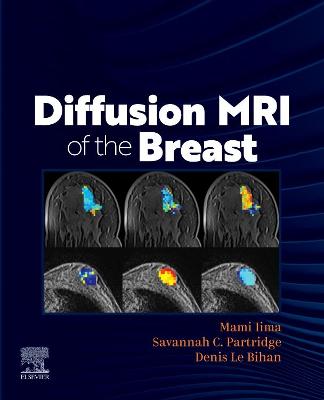 Book cover for Diffusion MRI of the Breast, E-Book
