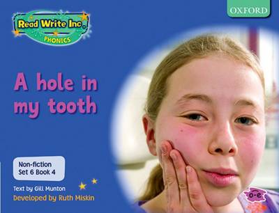 Book cover for Read Write Inc. Phonics: Non-fiction Set 6 (Blue): A hole in my tooth - Book 4