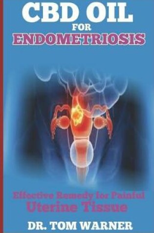 Cover of CBD Oil for Endometriosis