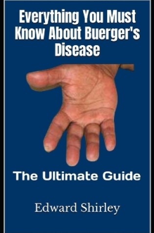 Cover of Everything You Must Know About Buerger's Disease