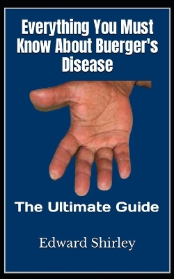 Book cover for Everything You Must Know About Buerger's Disease