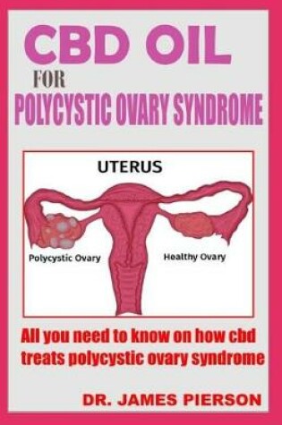 Cover of CBD Oil for Polycystic Ovary Syndrome