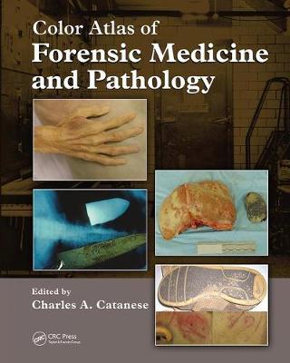 Cover of Color Atlas of Forensic Medicine and Pathology