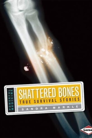 Cover of Shattered Bones