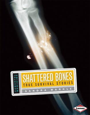 Cover of Shattered Bones