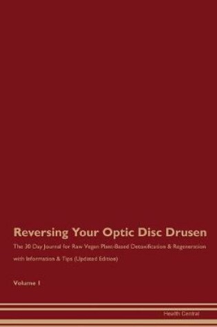 Cover of Reversing Your Optic Disc Drusen