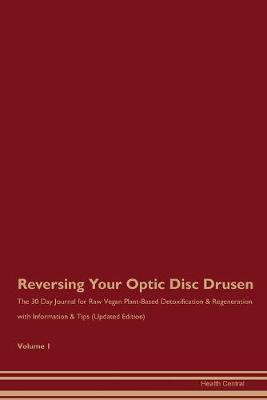 Book cover for Reversing Your Optic Disc Drusen