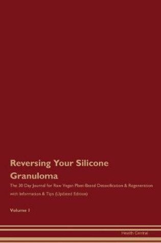 Cover of Reversing Your Silicone Granuloma