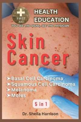 Book cover for Skin Cancer