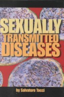 Book cover for Sexually Transmitted Diseases