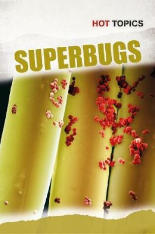 Cover of Superbugs