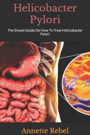 Cover of Helicobacter Pylori