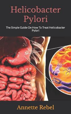 Book cover for Helicobacter Pylori