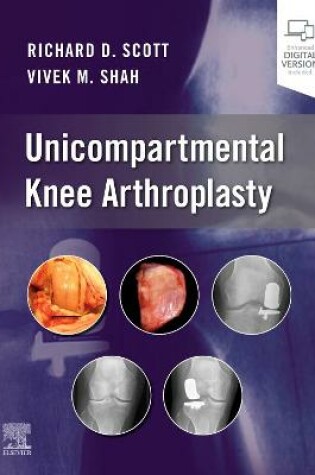 Cover of Unicompartmental Knee Arthroplasty