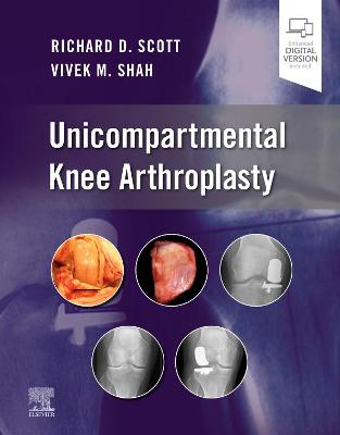 Book cover for Unicompartmental Knee Arthroplasty