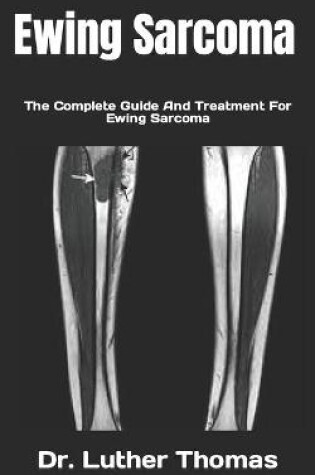 Cover of Ewing Sarcoma