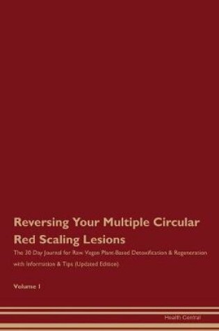 Cover of Reversing Your Multiple Circular, Red, Scaling Lesions