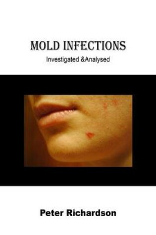 Cover of Mold Infections