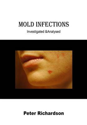 Book cover for Mold Infections