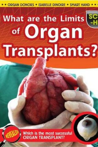 Cover of What Are the Limits of Organ Transplantation?