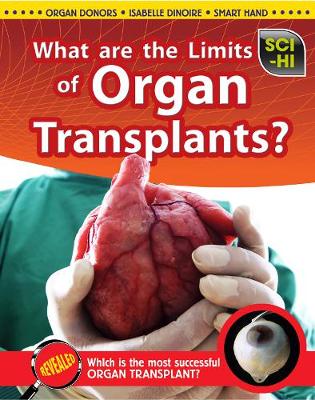 Book cover for What Are the Limits of Organ Transplantation?