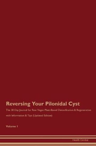 Cover of Reversing Your Pilonidal Cyst