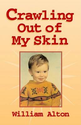 Book cover for Crawling Out of My Skin