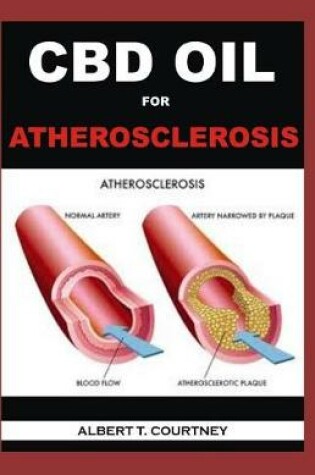 Cover of CBD Oil for Atherosclerosis