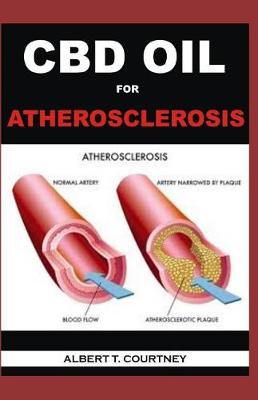 Book cover for CBD Oil for Atherosclerosis