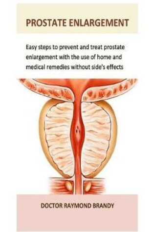 Cover of Prostate Enlargement