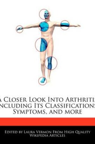 Cover of A Closer Look Into Arthritis Including Its Classifications, Symptoms, and More