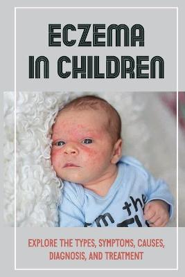 Book cover for Eczema In Children