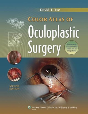 Book cover for Color Atlas of Oculoplastic Surgery