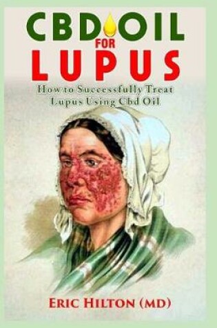 Cover of CBD Oil for Lupus