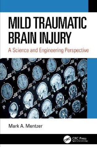 Cover of Mild Traumatic Brain Injury