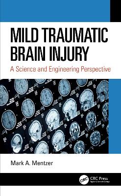 Book cover for Mild Traumatic Brain Injury