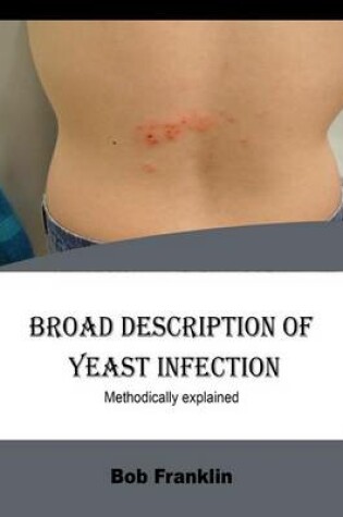 Cover of Broad Description of Yeast Infection