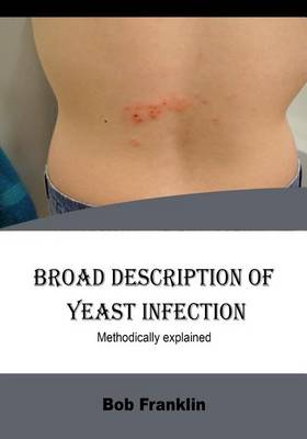 Book cover for Broad Description of Yeast Infection