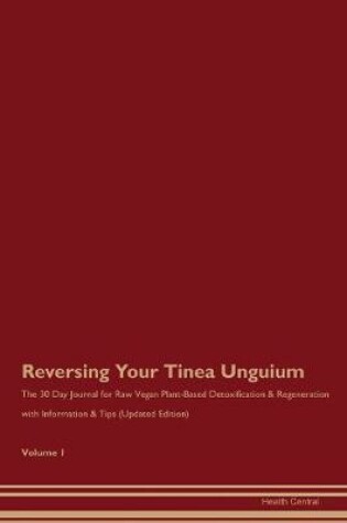 Cover of Reversing Your Tinea Unguium