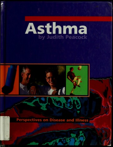 Book cover for Asthma