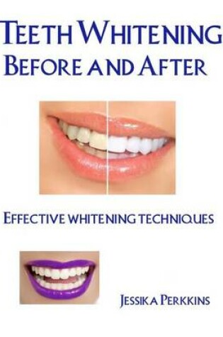 Cover of Teeth Whitening Before and After